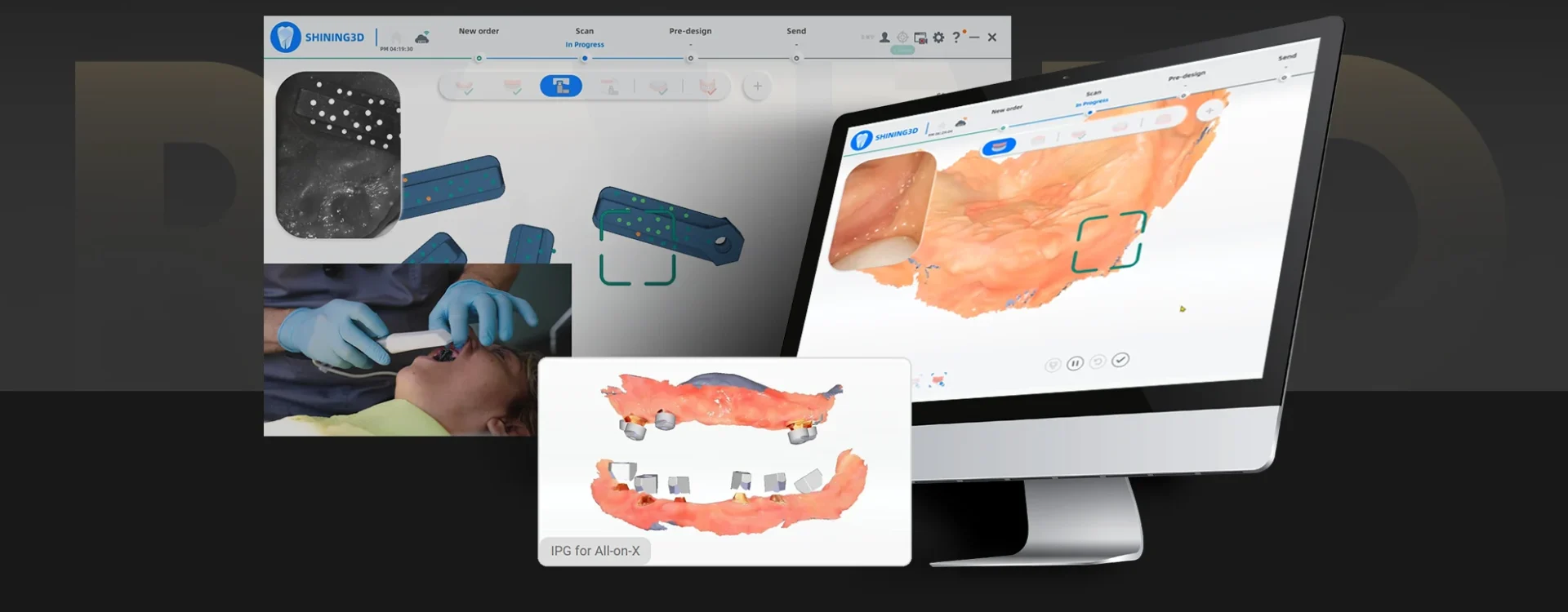 رابط کاربری دستگاه Aoralscan Elite