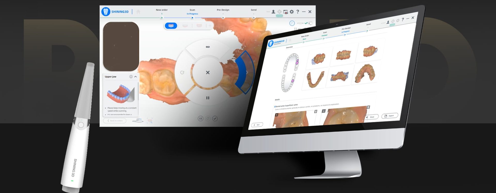 رابط کاربری دستگاه Aoralscan 3 wireless